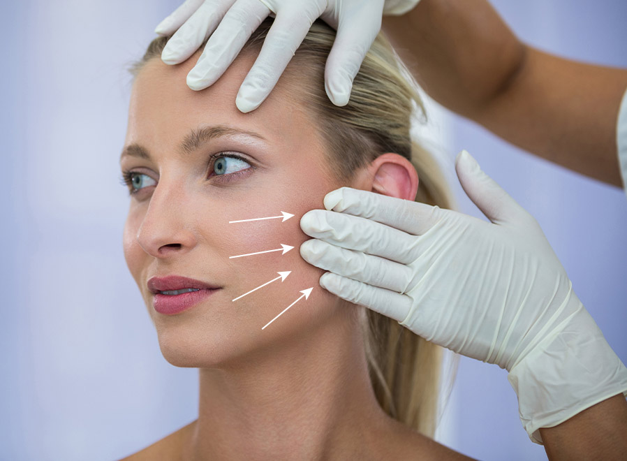 Lifting cervico-facial