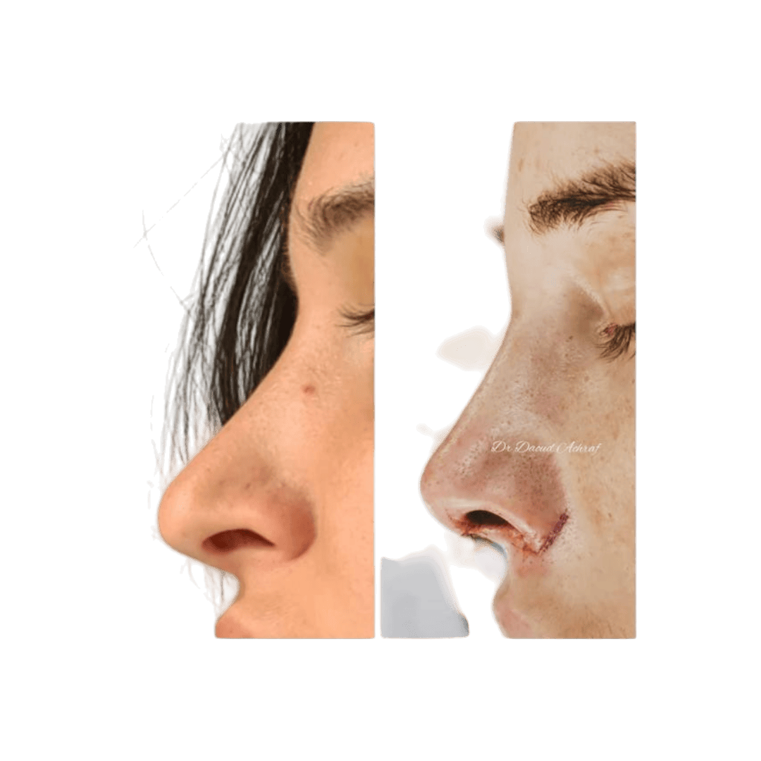 Résultat 1