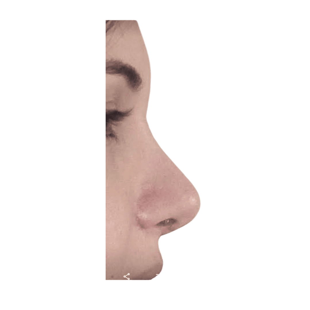 Résultat 3