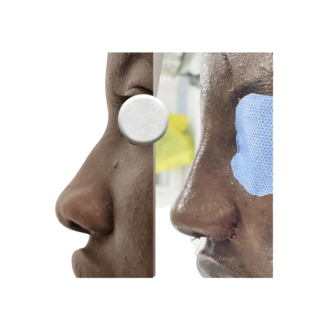 Résultat 7