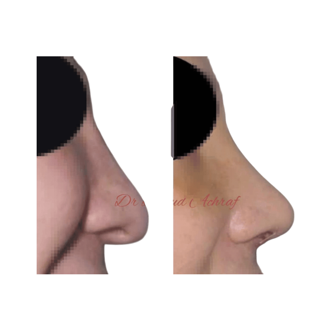 Résultat 9