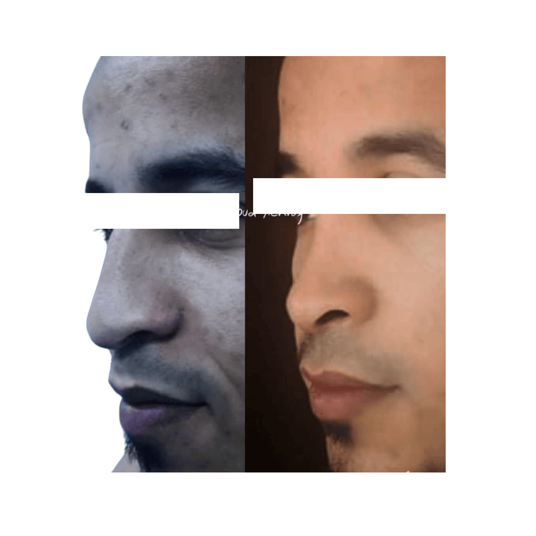 Résultat 12